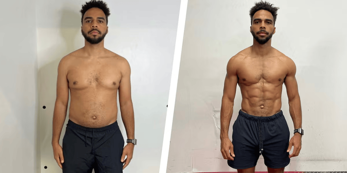 Synedica Retatrutide before and after weight loss result 9 (-13 kg · 95 days)