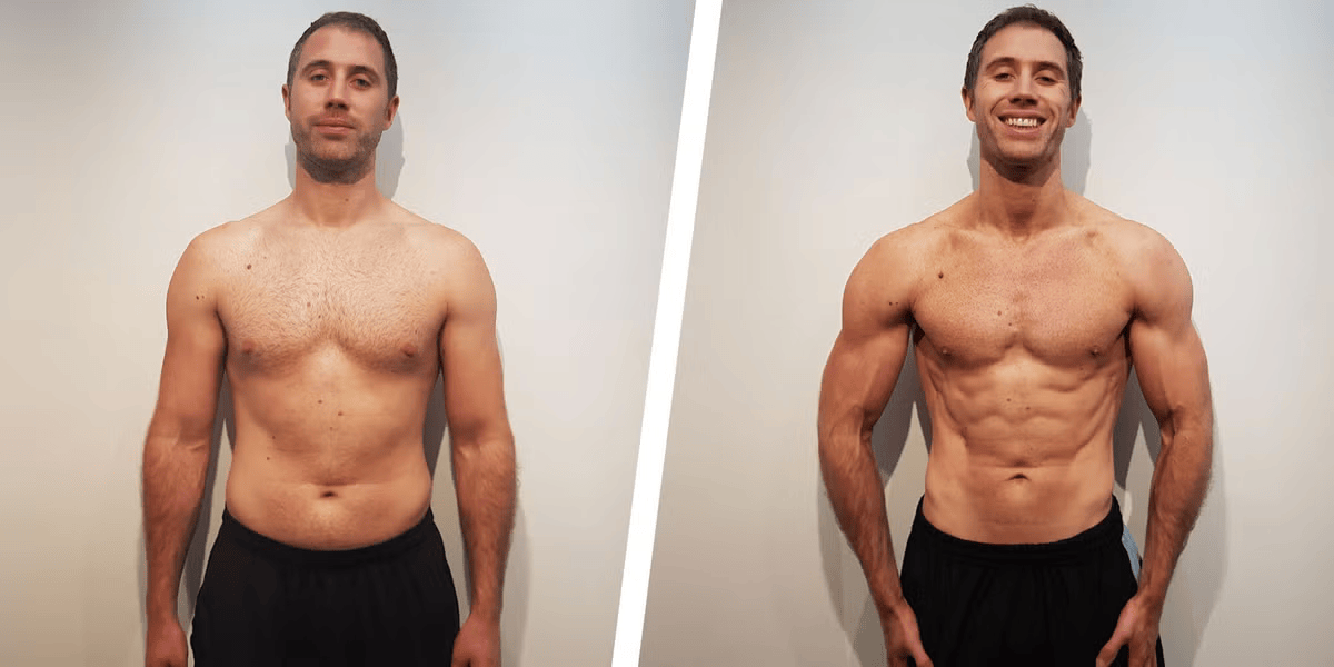 Synedica Retatrutide before and after weight loss result 7 (-15 kg · 110 days)