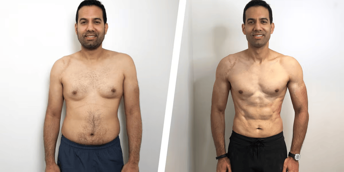 Synedica Retatrutide before and after weight loss result 5 (-16 kg · 90 days)