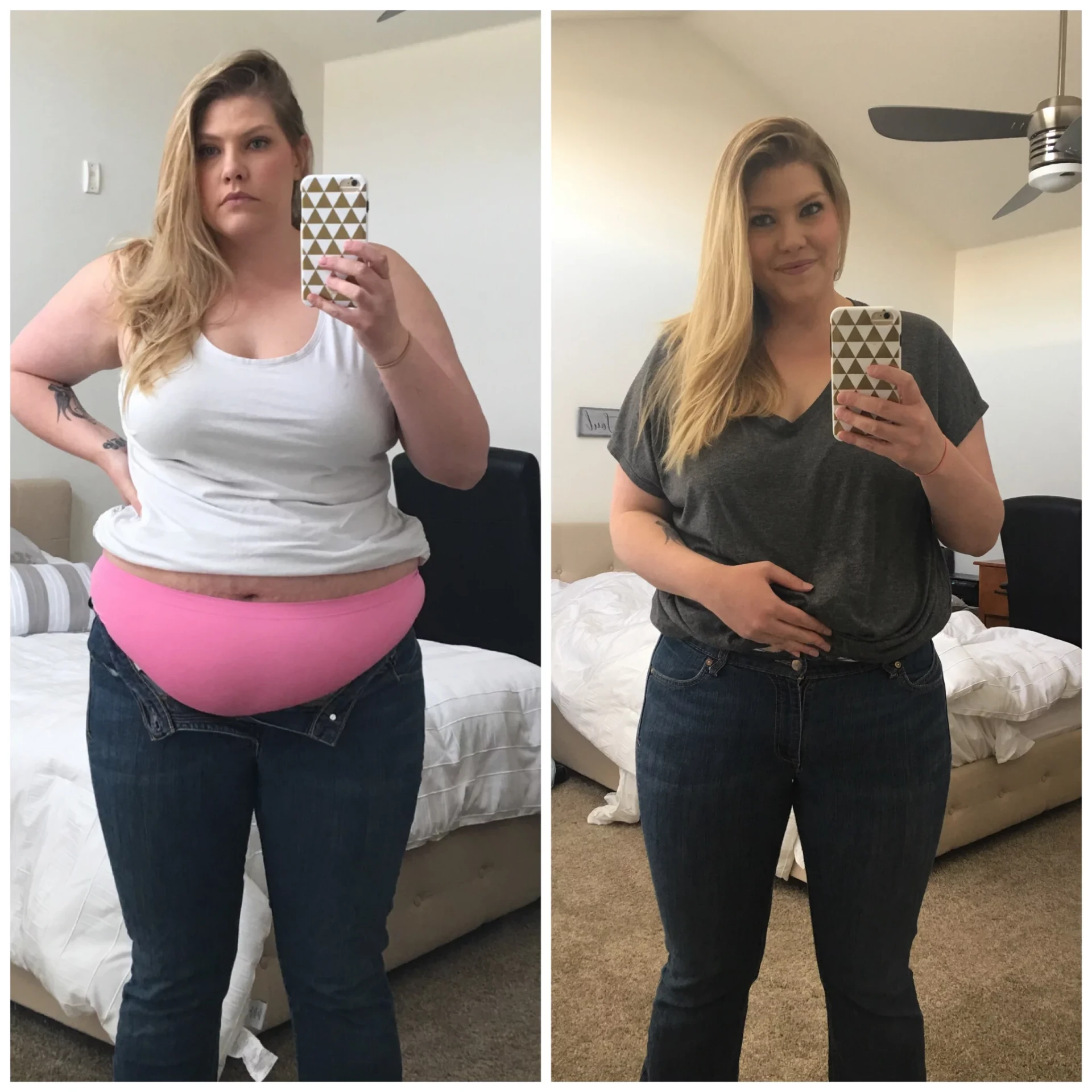 Synedica Retatrutide before and after weight loss result 4 (-18 kg · 90 days)
